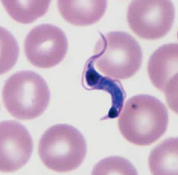 Imagen B: Tripomastigote de Trypanosoma cruzi en un frotis de sangre coloreado con Giemsa. Fíjese en la ubicación más anterior del núcleo (Fotografía cortesía del CDC).