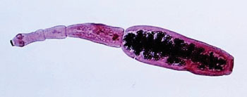 Imagen: Una microfotografía de la morfología ultraestructural mostrado un cestodo adulto, Echinococcus granulosus (Fotografía cortesía del Dr. Peter M. Schantz).