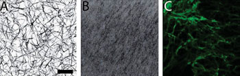 Imagen A: Una microscopía confocal de barrido láser de coágulos construidos a partir de fibrinógeno adulto (A), fibrinógeno neonatal (B), o una mezcla de los dos (C) Escala = 20 micras (Fotografía cortesía de la Universidad Estatal de Carolina del Norte).