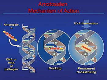 Imagen: Un diagrama de la combinación de amotosaleno e iluminación UVA para la eliminación de agentes patógenos de la sangre donada para transfusiones (Magdy El Ekiaby, MD).