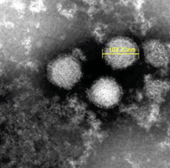Imagen B: Una micrografía electrónica de barrido (SEM) del virus del síndrome de trombocitopenia con fiebre severa (Fotografía cortesía del Instituto Nacional Japonés de Enfermedades Infecciosas).
