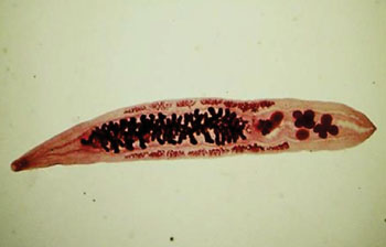 Imagen: Un Opistorchis viverrini, adulto, o fasciola hepática del sudeste asiático, coloreada con carmín (Fotografía cortesía del CDC).