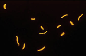 Imagen: Una microfotografía de Mycobacterium tuberculosis coloreada con auramina-rodamina (Fotografía cortesía del Dr. T.V. Rao, MD).