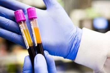 Imagen: La prueba de sangre de 7-genes les puede permitir a los médicos determinar si sus pacientes tienen una infección bacteriana o viral (Fotografía cortesía de Erin Kunkel y el Centro Médico de la Universidad de Stanford).