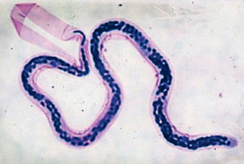 Imagen: Una microfilaria de Wuchereria bancrofti en una gota gruesa coloreada con Giemsa (Fotografía cortesía del CDC).
