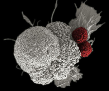 Imagen: Una micrografía electrónica de barrido (SEM) muestra una célula de cáncer escamoso oral (blanco) que es atacada por dos células T citotóxicas (rojo). Las células T específicas del tumor se desarrollaron a partir del propio sistema inmune del paciente, una “vacuna personalizada contra el cáncer “como las que se puedan desarrollar en el futuro con la ayuda de los genomas humanos estandarizados del NIST como materiales de referencia (Fotografía cortesía de R.E. Serda / NCI).