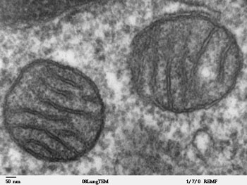 Imagen: Una micrografía electrónica de barrido (SEM) de dos mitocondrias de tejido pulmonar de mamíferos exhibiendo la matriz y las membranas (Fotografía cortesía de Wikimedia Commons).
