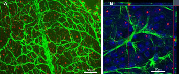 Imagen: Un experimento que examina el tejido de retina en busca de depósitos de mHtt en astrocitos GFAP-ir, en el modelo de ratón R6/2 de la enfermedad de Huntington. Verde: proteína ácida glial fibrilar (GFAP); Rojo: la proteína huntingtina mutante (mHtt). (A) Una imagen en bajo aumento ilustra los astrocitos GFAP-ir y los depósitos de mHtt provenientes del montaje completo de la retina del ratón de 12 semanas R6/2 (modelo de la enfermedad de Huntington). Escala = 50 micras. (B) Un análisis confocal detallado de positividad de GFAP, la inmunoreactividad de mHtt y la coloración de contraste DAPI (azul) no revelaron colocalización de GFAP y mHtt. Escala = 20 micras (Imagen cortesía de PLoS One).
