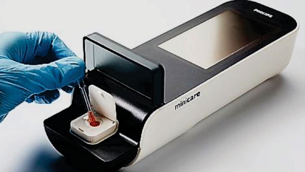 Imagen: La prueba de sangre para los puntos de atención, del sistema de Minicare I-20, para el diagnóstico rápido de un ataque del corazón (Fotografía cortesía de Philips Healthcare).