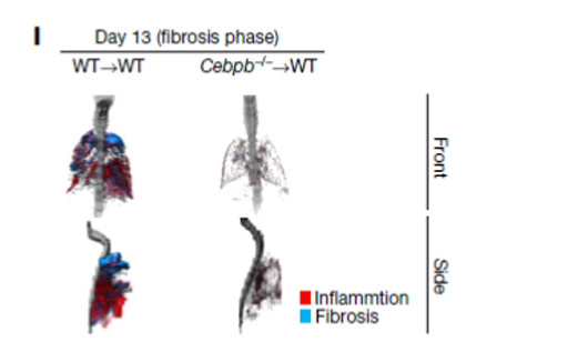 Imagen: Un análisis de resonancia magnética - la falta de SatM dio lugar a la resistencia a la fibrosis en ratones (Imagen cortesía del laboratorio del profesor Akira, IFReC, Universidad de Osaka).