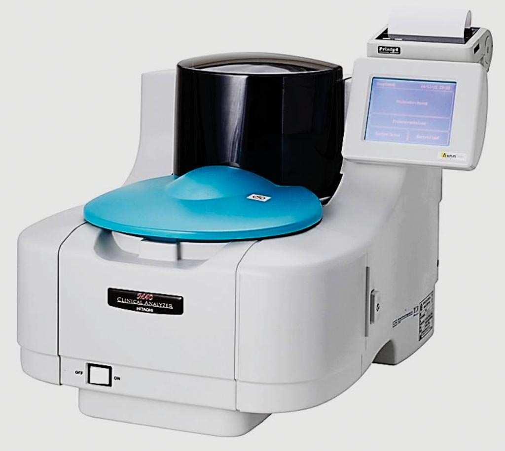Imagen: El analizador automatizado de química, M40, para la HbA1c (Fotografía cortesía de Hitachi).