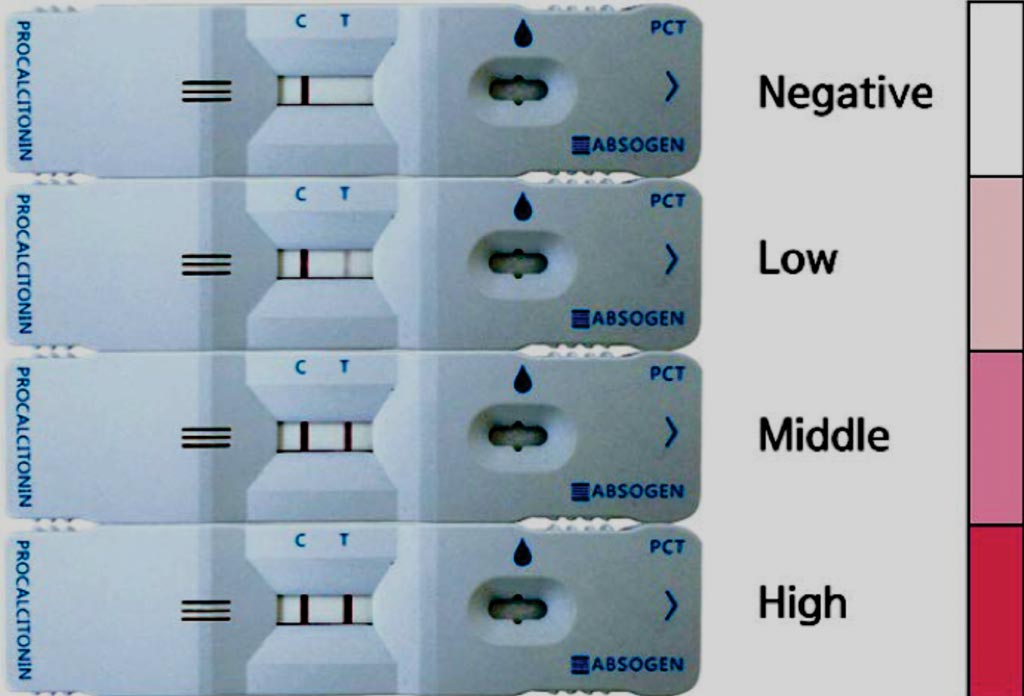Imagen: El análisis ABSOGEN PCT: línea de control (C) y línea de prueba (T) del kit semi-cuantitativo para el análisis de la procalcitonina. Negativo (