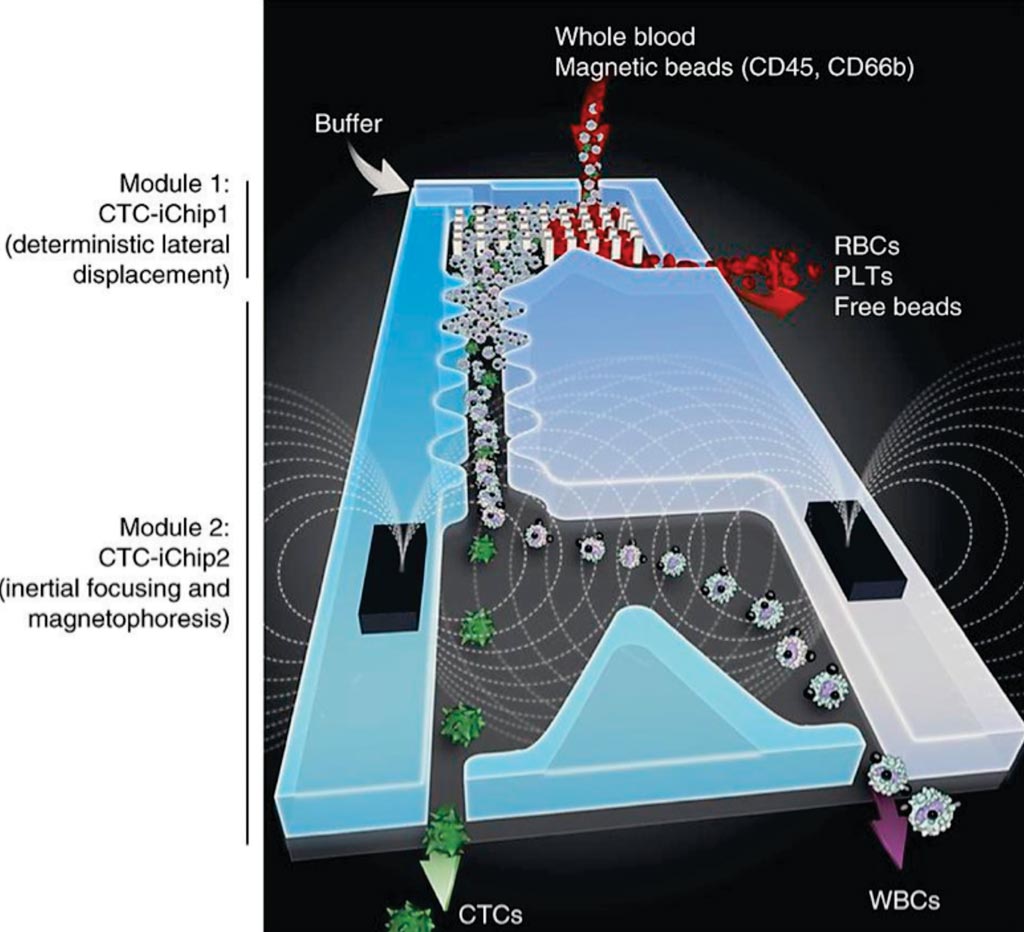 Imagen: El iChip para células tumorales circulantes (CTC) se compone de dos dispositivos microfluídicos separados que contienen tres componentes microfluídicos diferentes diseñados para operaciones en línea (Fotografía cortesía del Hospital General de Massachusetts).