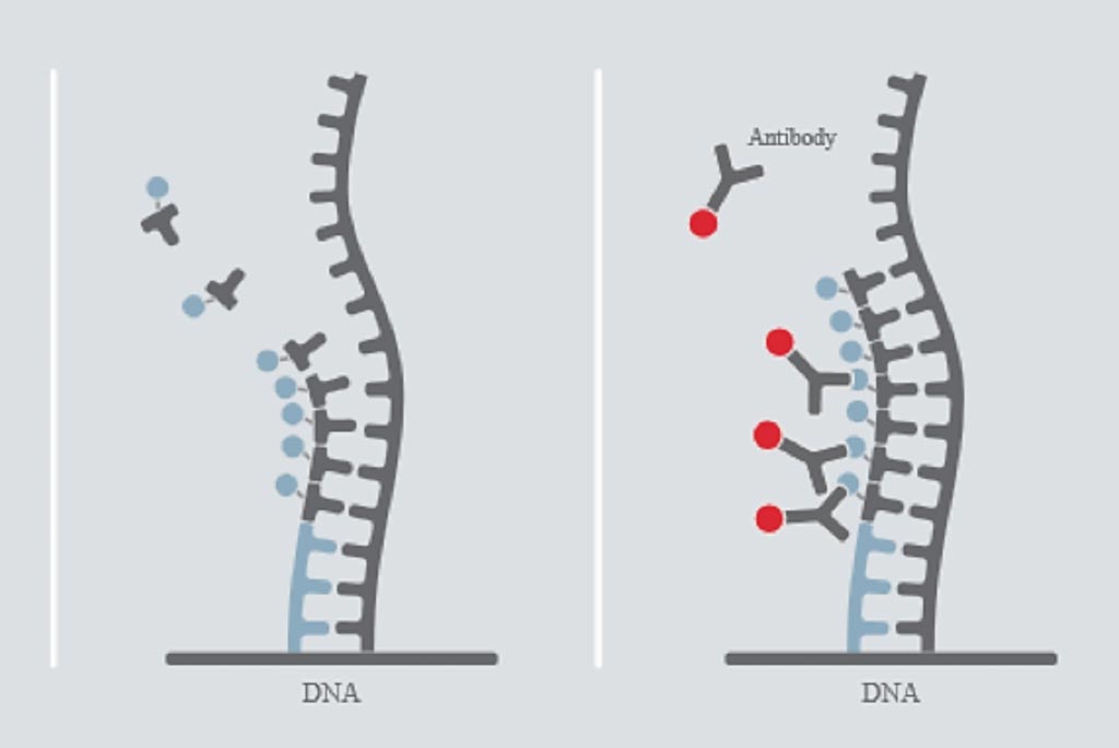 Imagen: Un diagrama del ensayo DiviTum: La BrdUTP se incorpora en una hebra de ADN de fase sólida. La BrdU incorporada se detecta utilizando un anticuerpo monoclonal anti-BrdU conjugado con la enzima generadora de señal, fosfatasa alcalina. El nivel de BrdU, incorporado en el tiempo, es proporcional al nivel de actividad de la timina quinasa en la muestra (Fotografía cortesía de Biovica).