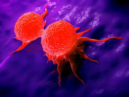 Imagen: Micrografía electrónica de barrido (SEM) de las células de cáncer colorrectal en división (Fotografía cortesía del MNT).