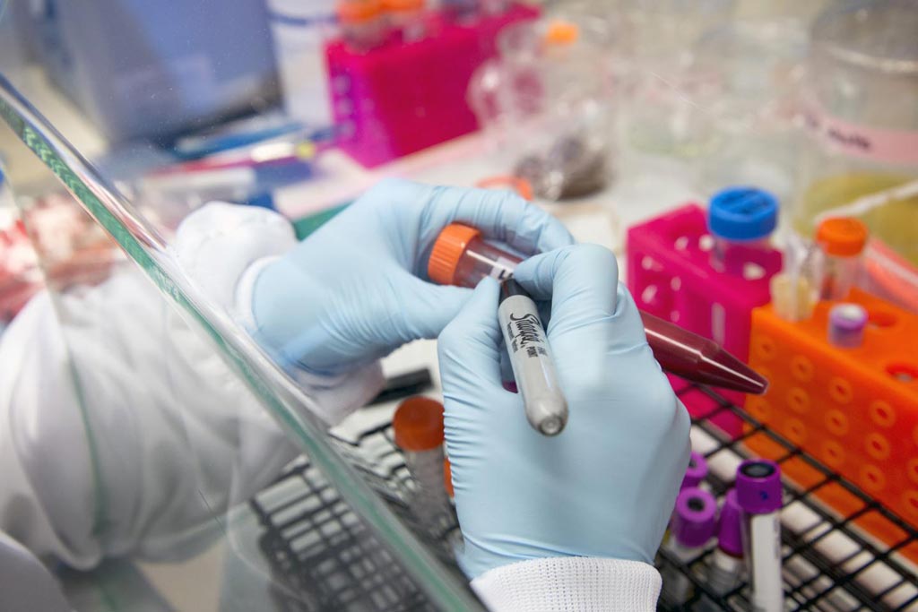 Imagen: Se está realizando una nueva investigación de ADN para comprender mejor los riesgos genéticos de la enfermedad (Fotografía cortesía de Clare McLean, Universidad de Washington Medicina).