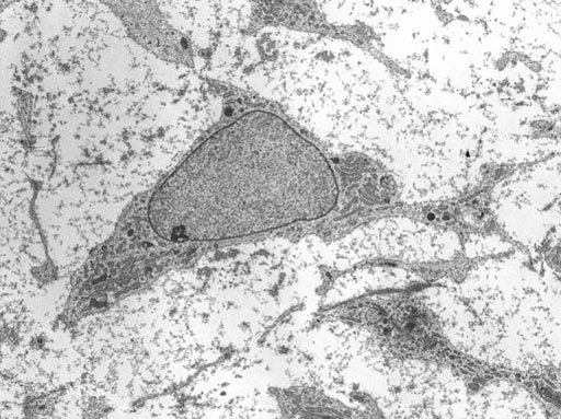 Imagen: Micrografía electrónica de transmisión (TEM) de una célula madre mesenquimal que presenta características ultraestructurales típicas (Fotografía cortesía de Robert M. Hunt).