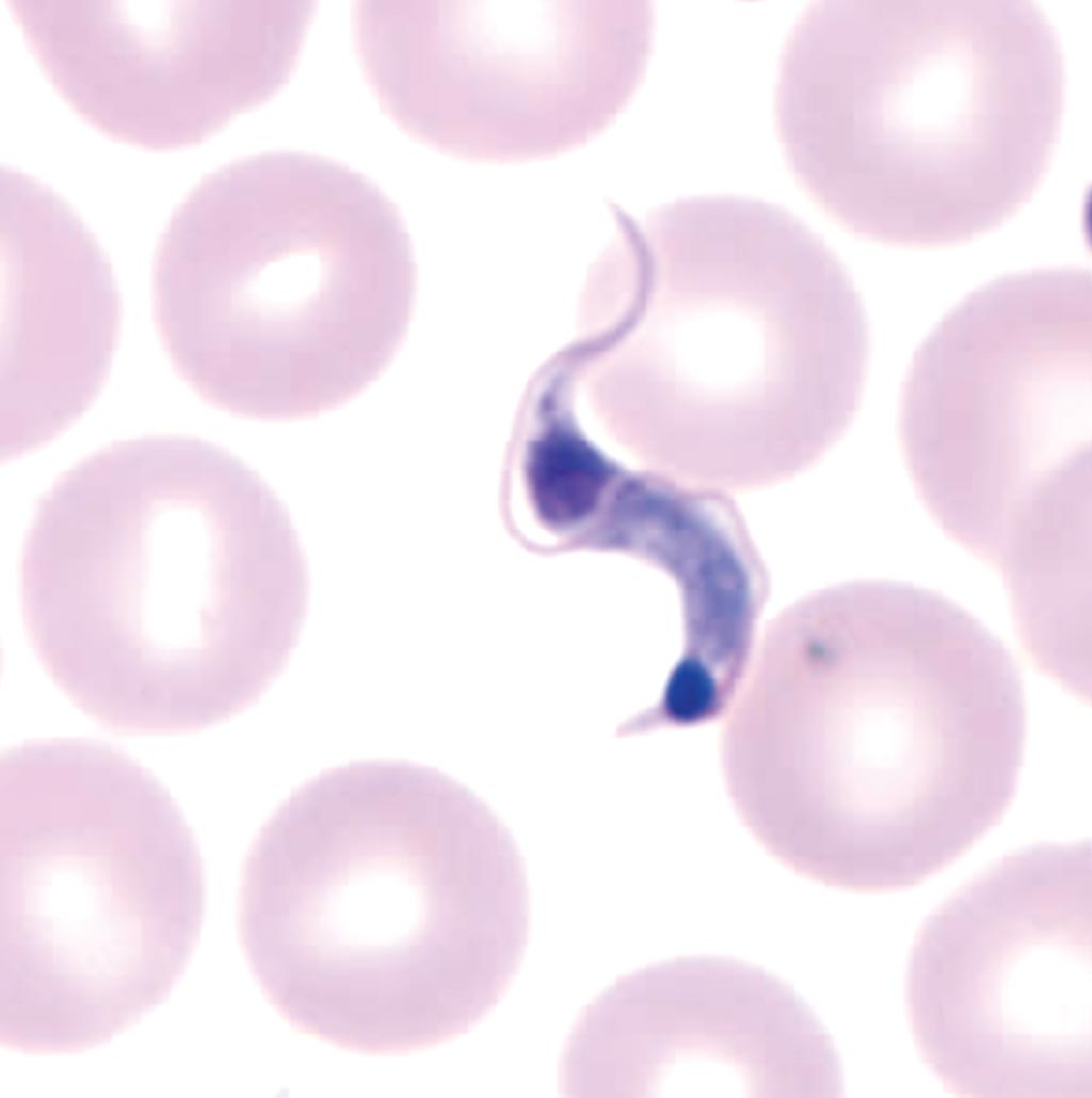 Imagen: Un tripomastigote de Trypanosoma cruzi en un frotis de sangre coloreado con Giemsa de un paciente con enfermedad de Chagas (Fotografía cortesía del CDC).