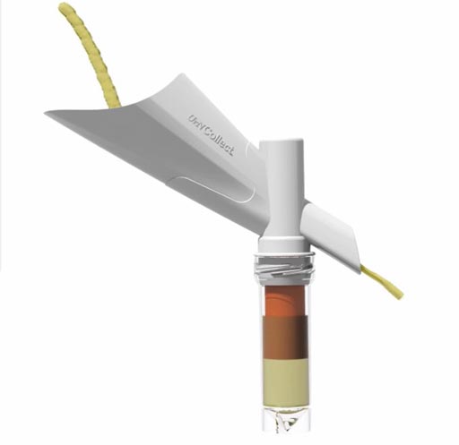 Imagen: El dispositivo UrNCollect está diseñado para uso con el kit de análisis de diagnóstico in vitro (IVD) SelectMDx para el cáncer de próstata (Fotografía cortesía de MDxHealth).