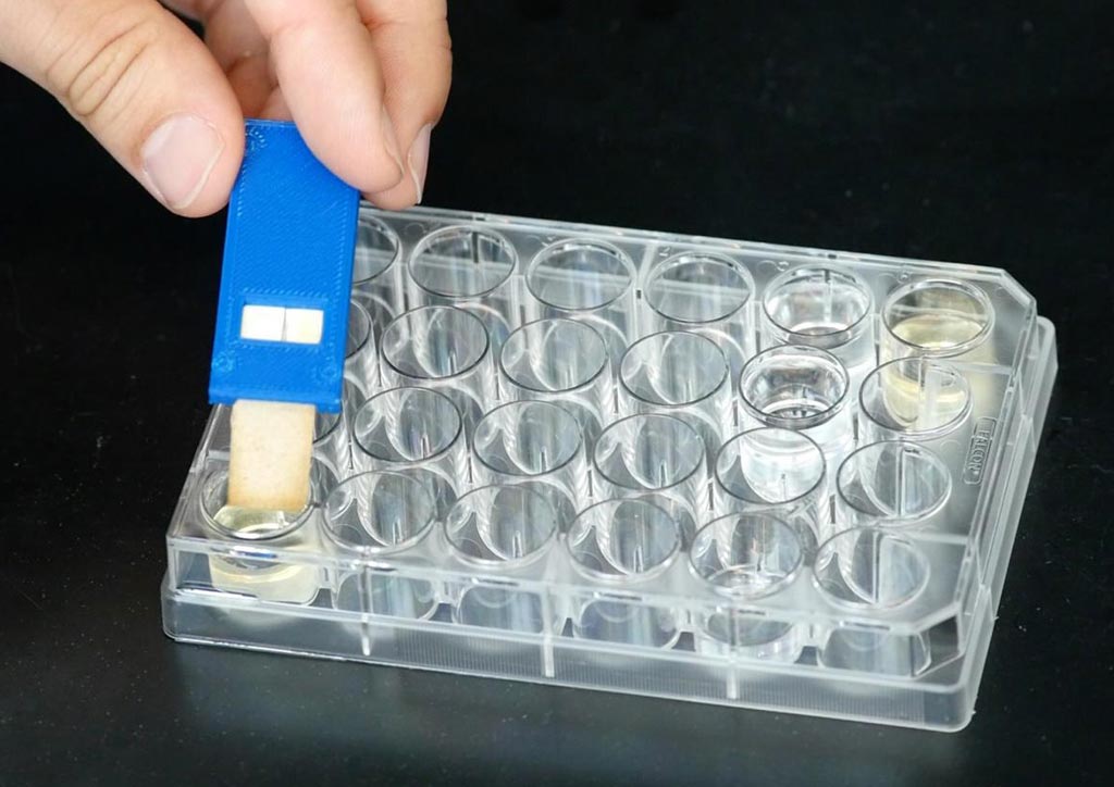 Imagen: El dispositivo de tiras reactivas, un biosensor de un solo componente, personalizable y barato, utiliza células vivas para detectar patógenos en todo el mundo (Fotografía cortesía de la Universidad de Columbia).