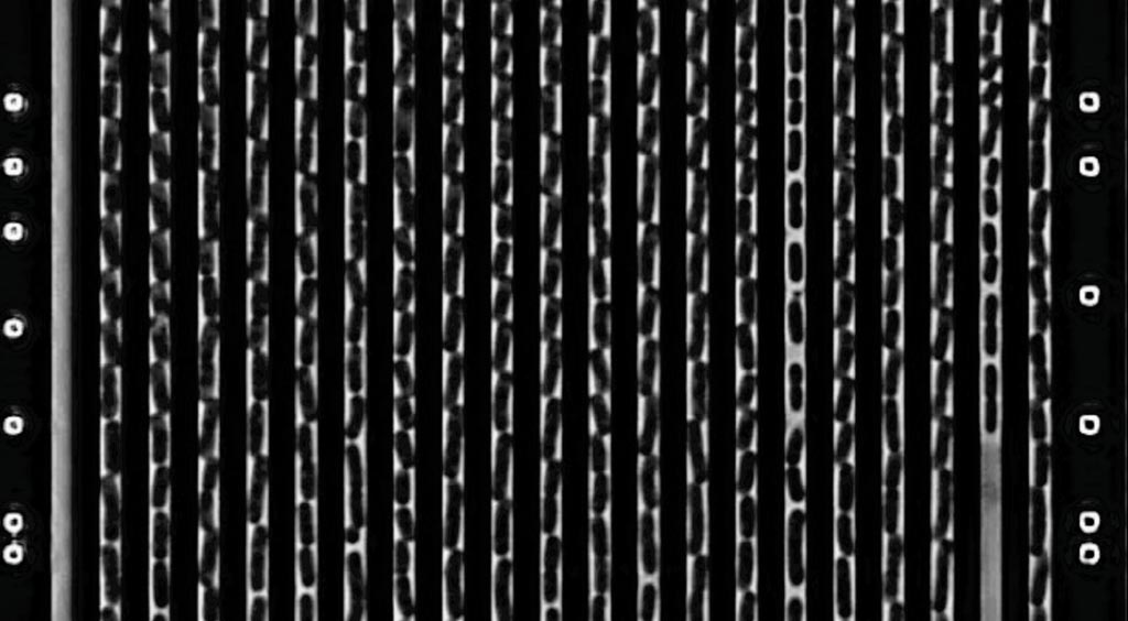Imagen: Fotografía en contraste de fase de Klebsiella pneumoniae creciendo en el chip microfluídico. Las bacterias tienen 3 μm de largo y se dividen cada 30 minutos (Fotografía cortesía de Özden Baltekina et al).