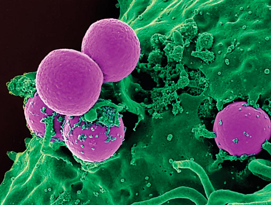 Imagen: Una microfotografía electrónica de barrido (SEM) de un neutrófilo humano ingiriendo un Staphylococcus aureus resistente a la meticilina (SARM) (Fotografía cortesía del Instituto Nacional de Alergia y Enfermedades Infecciosas).