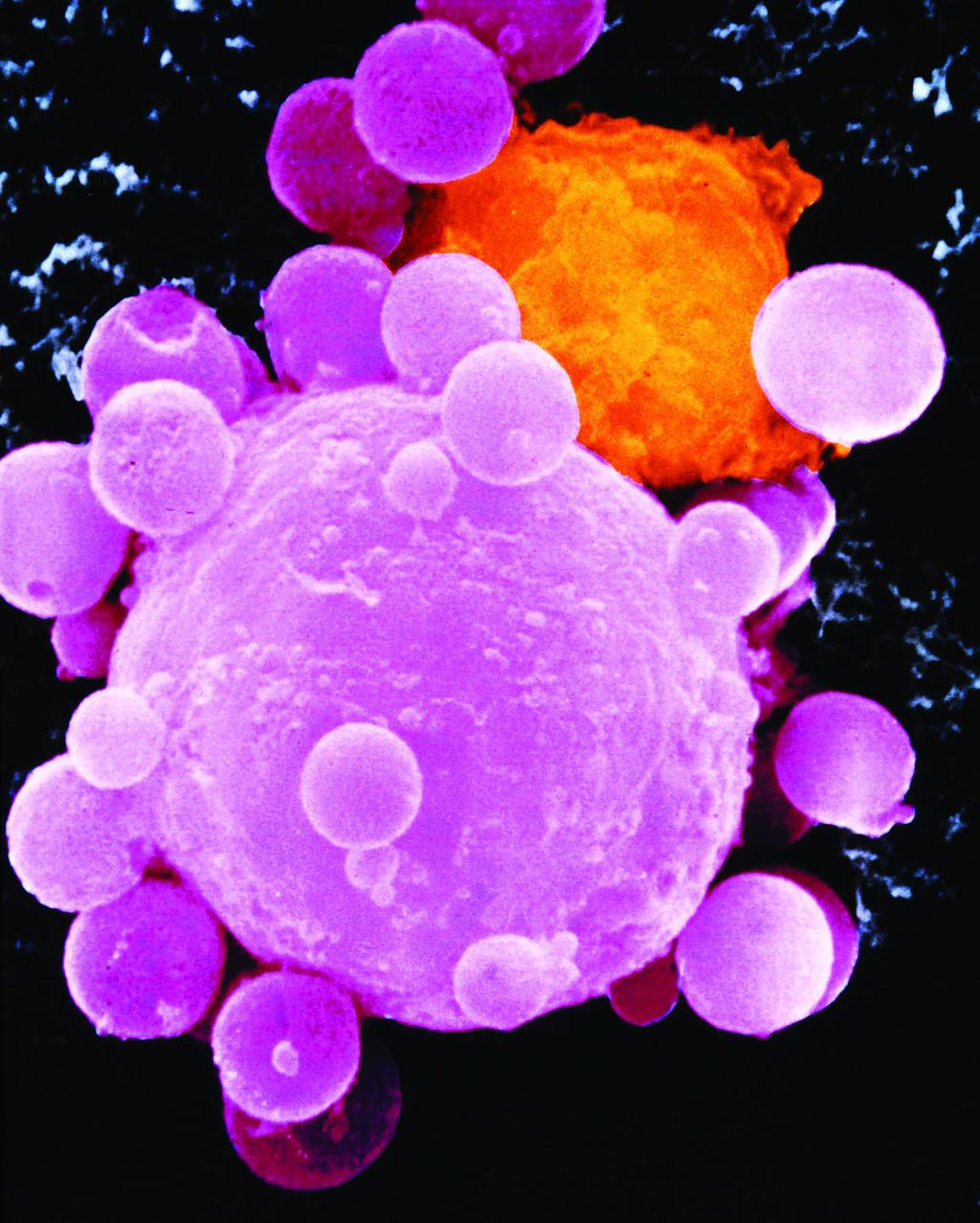 Imagen: Una microfotografía electrónica de barrido a color (SEM) de una célula de cáncer de pulmón durante la división celular (Fotografía cortesía de los Institutos Nacionales de Salud).