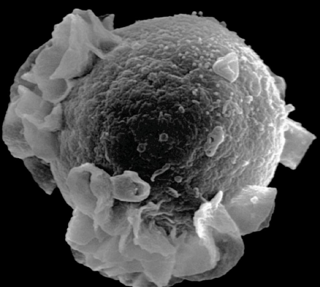 Imagen: Una microfotografía electrónica de barrido (SEM) del virus de Epstein-Barr que brota de una célula B (Fotografía cortesía del Foro de Descubrimiento de la Esclerosis Múltiple).