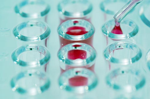 Imagen: En un nuevo estudio, los investigadores descubrieron que el análisis de muestras de biopsia líquida en sangre para detectar mutaciones genómicas en el ctADN podría ayudar a revelar qué pacientes tienen probabilidad de responder a la CII (Fotografía cortesía de John Shepherd).