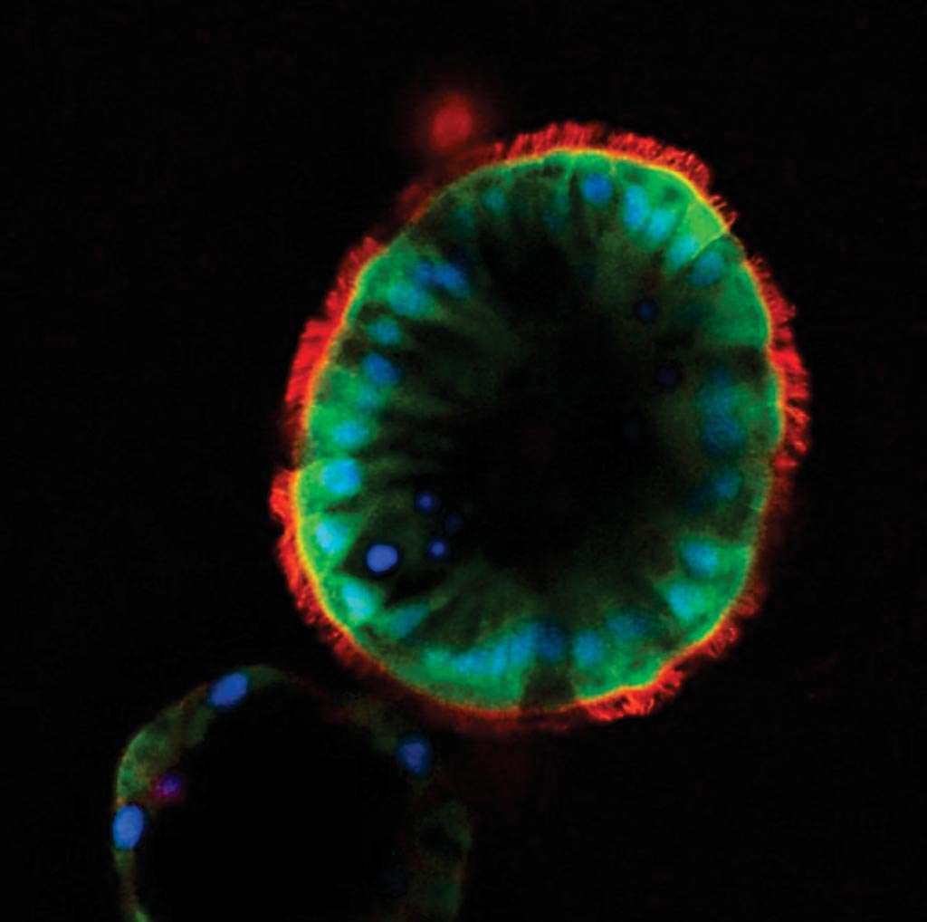 Imagen: una microscopía confocal fluorescente de los naosferoides vivientes desarrollados a partir de un tejido nasal de un paciente con fibrosis quística (Fotografía cortesía de la Universidad de Carolina del Norte).