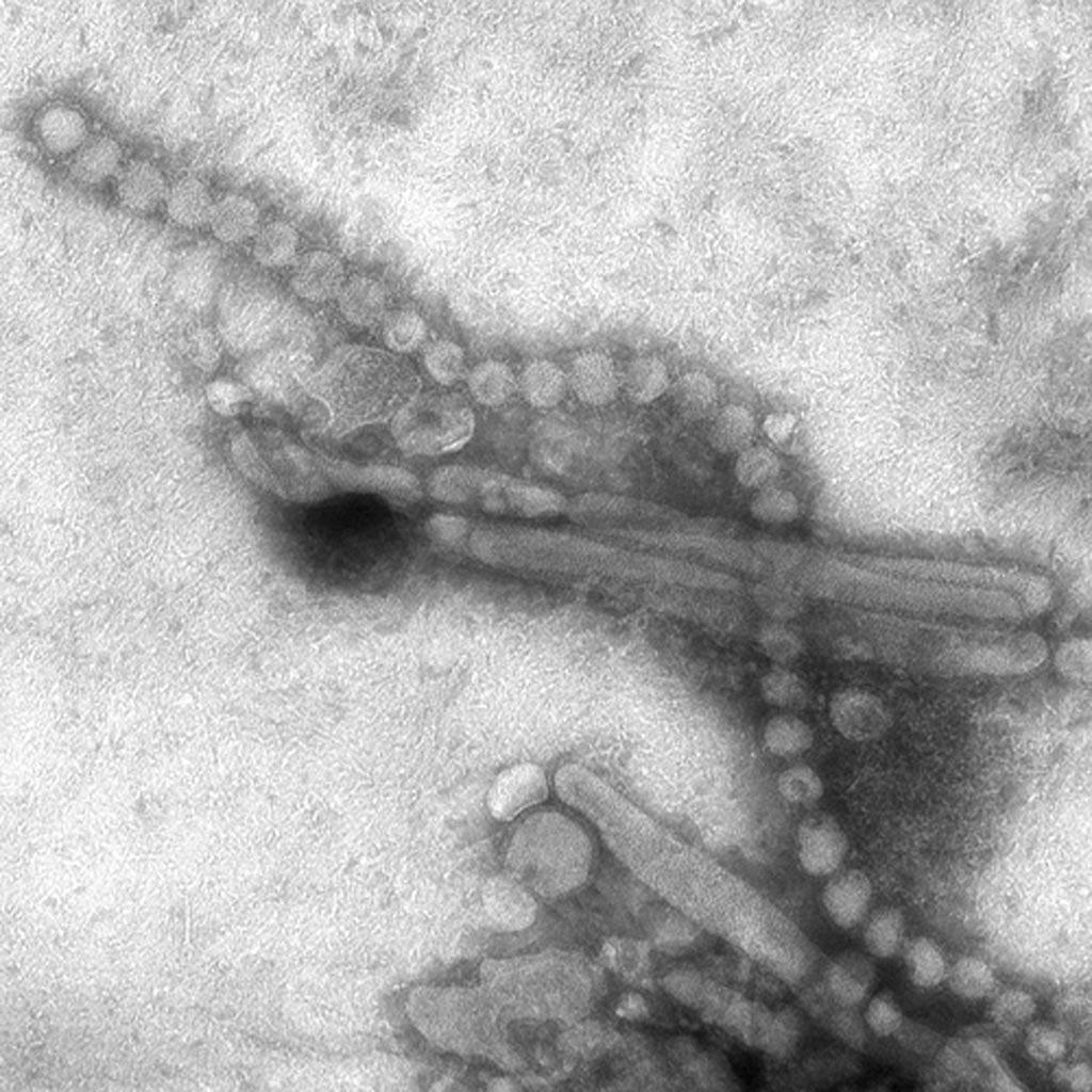 Imagen: Una imagen de microscopio electrónico de barrido (SEM) del virus respiratorio de la Influenza A H7N9 (Fotografía cortesía del CDC).