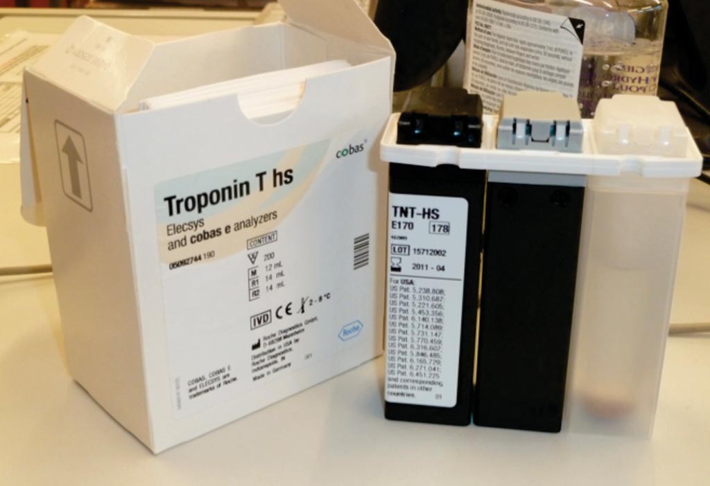 Imagen: El kit de análisis Troponin T hs mejora la detección y exclusión de la lesión del miocardio en las primeras etapas (Fotografía cortesía de Roche Diagnostics).