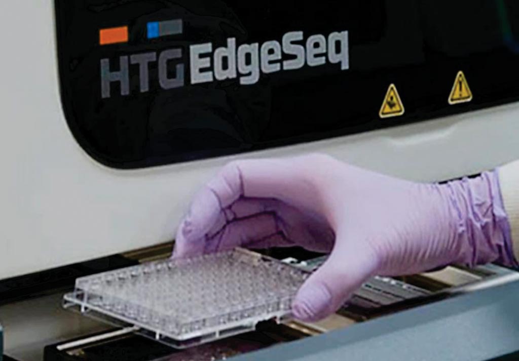 Imagen: El procesador HTG EdgeSeq, los análisis y el software analizador, facilitan el análisis de los perfiles de expresión génica de una amplia variedad de tipos de muestras (Fotografía cortesía de HTG Molecular Diagnostics).