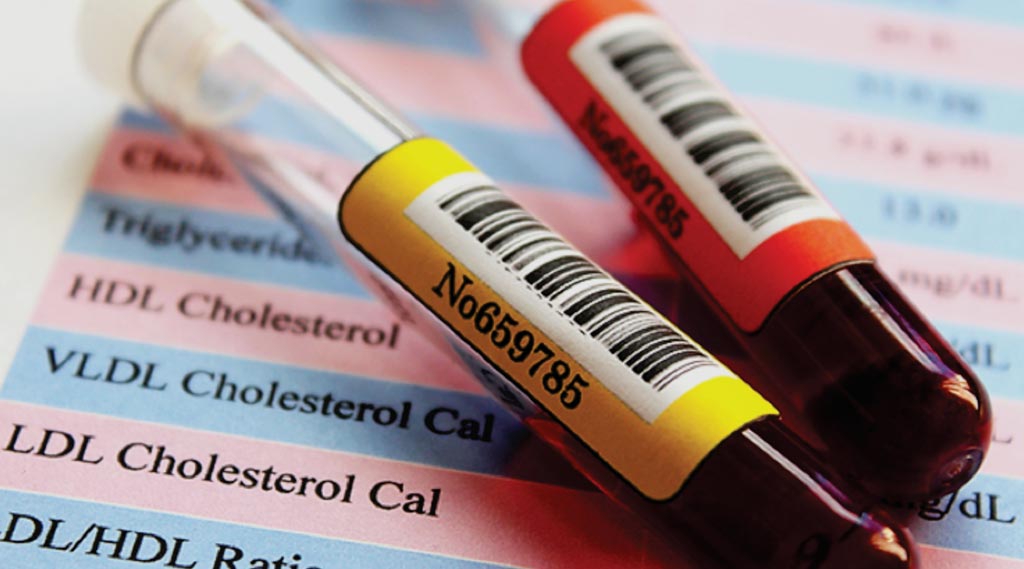 Imagen: Una nueva prueba exacta de colesterol puede permitir que los pacientes no tengan que ayunar (Fotografía cortesía de la Facultad de Medicina Johns Hopkins).