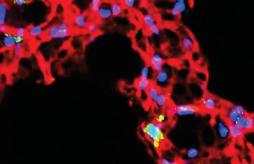 Imagen: La frecuencia y actividad de las células T convencionales sirve como una firma inmune de la infancia temprana que predice el desarrollo del asma posteriormente. Las células iNKT se muestran en verde, la vasculatura pulmonar en rojo y los núcleos celulares en azul (Fotografía cortesía de la Dra. Catherine Crosby, Instituto La Jolla para Alergia e Inmunología).
