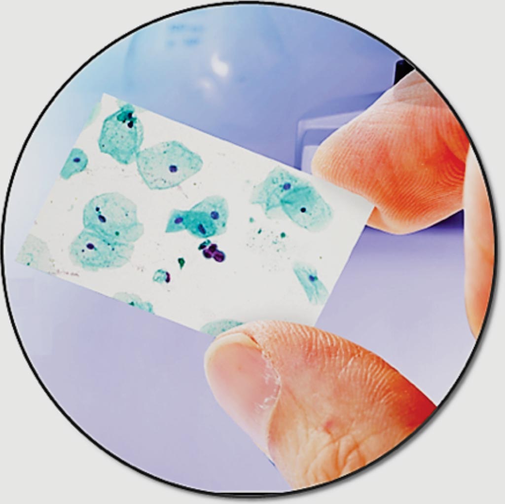 Imagen: La plataforma CellDetect es la única solución histoquímica que proporciona discriminación de color entre las células normales, precancerosas y cancerígenas junto con el examen morfológico (Fotografía cortesía de Micromedic Technologies).