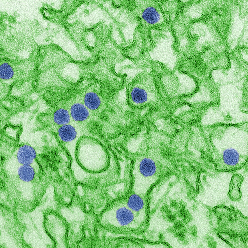 Imagen: Una micrografía electrónica de transmisión (TEM) con coloración digital del virus del Zika. Las partículas de virus (de color azul) tienen 40 nanómetros de diámetro con una envoltura exterior y un núcleo interno denso (Fotografía cortesía del CDC).