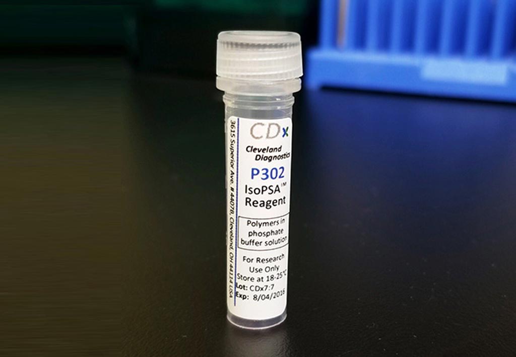 Imagen: El IsoPSA es una nueva prueba de sangre para la predicción exacta del riesgo general de cáncer de próstata maligno (Fotografía cortesía de la Clínica Cleveland).
