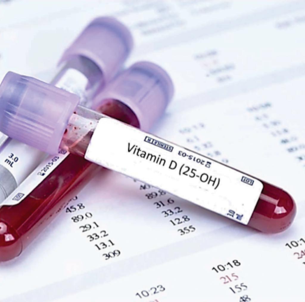 Imagen: Un análisis de sangre para la vitamina D; la insuficiencia está relacionada con el aborto espontáneo en mujeres con pérdida previa del embarazo (Fotografía cortesía de Blood Tests London).