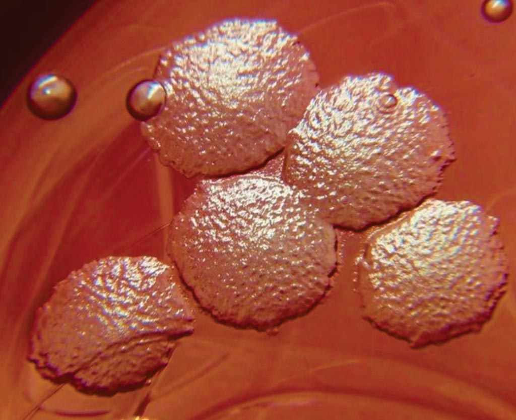 Imagen: Colonias de Pseudomonas aeruginosa en agar sangre después del cultivo durante 48 horas a 37°C. Las colonias pequeñas y lisas son Enterococcus faecalis (Fotografía cortesía de microbiologypictures).