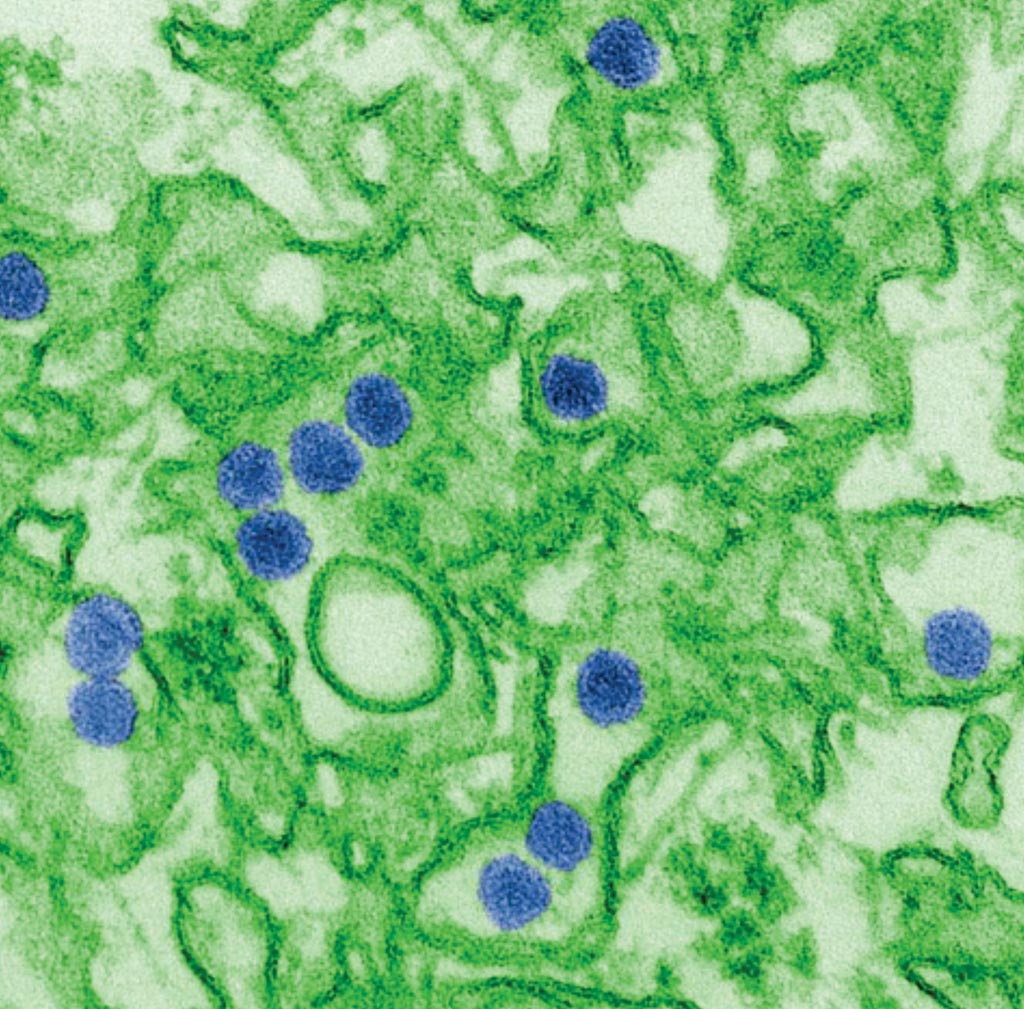 Imagen: Una imagen de microscopía electrónica de transmisión (TEM) coloreada digitalmente del virus Zika, que es un miembro de la familia, Flaviviridae. Las partículas de virus, aquí de color azul, tienen un diámetro de 40 nm, con una envoltura exterior y un núcleo interno denso (Fotografía cortesía de Cynthia Goldsmith).