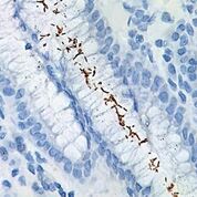 Imagen: Inmunocoloración de la infección por Helicobacter pylori en el intestino delgado. La pequeña bacteria con forma de espiral se puede ver claramente en el microscopio usando un objetivo de inmersión × 100 (Fotografía cortesía de BioCare Medical).