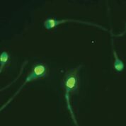 Imagen: La prueba Cap-Score detecta y analiza los patrones de localización mediante microscopía fluorescente para diferenciar las células espermáticas fértiles de las infértiles (Fotografía cortesía de Androvia LifeSciences).