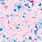 Imagen: Fotomicrografía de Mycobacterium tuberculosis usando la coloración de Ziehl-Neelsen en un frotis de esputo (Fotografía cortesía de la Universidad de Rockefeller).
