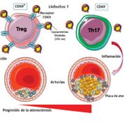 Imagen: Un diagrama del papel de CD69 en la aterosclerosis (Fotografía cortesía del Centro Nacional Español para Investigaciones Cardiovasculares).
