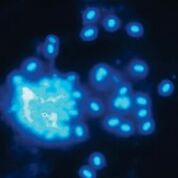 Imagen: Esporas de microsporidios coloreadas con Blanco de Calcofluor M2R (Fotografía cortesía del Instituto Pasteur de Túnez).