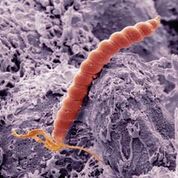 Imagen: Una micrografía electrónica de barrido a color (SEM) de la bacteria Helicobacter pylori (roja) en el estómago (Fotografía cortesía de Steve Gschmeissner / SPL).