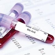 Imagen: El análisis de sangre de los ácidos biliares se usa para predecir el riesgo de muerte fetal al nacer (Fotografía cortesía de bluehorizon).