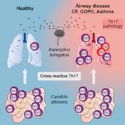 Imagen: Un diagrama de cómo la inmunidad y patología Th17 antifúngica humana se basan en la reactividad cruzada contra Candida albicans (Fotografía cortesía de la Universidad de Kiel).