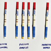 Imagen: Tiras reactivas del kit de análisis de flujo lateral de antígeno criptocócico IMMY (LFA) (Fotografía cortesía del Instituto de Investigación Médica, Kuala Lumpur, Malasia).